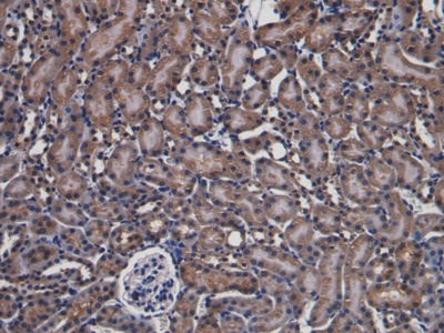 Polyclonal Antibody to Parkinson Disease Protein 7 (PARK7)