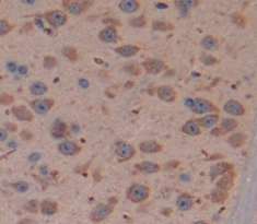 Polyclonal Antibody to DIX Domain Containing Protein 1 (DIXDC1)