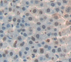 Polyclonal Antibody to Growth Arrest And DNA Damage Inducible Protein Alpha (GADD45a)
