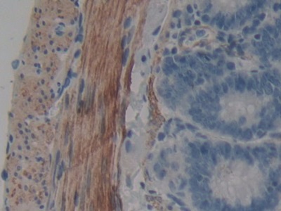 Polyclonal Antibody to WNT Inhibitory Factor 1 (WIF1)