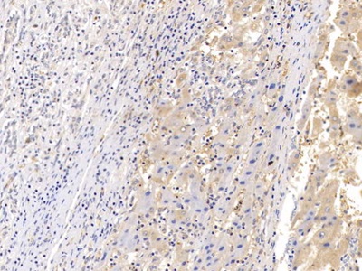 Polyclonal Antibody to Prolactin Induced Protein (PIP)