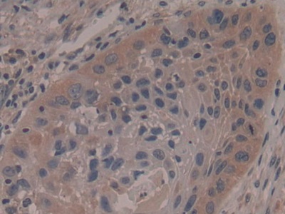 Polyclonal Antibody to Ribosomal Protein S6 Kinase Alpha 1 (RPS6Ka1)