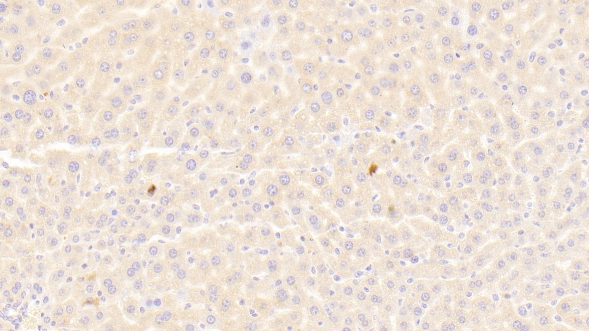 Polyclonal Antibody to TNFRSF1A Associated Via Death Domain Protein (TRADD)