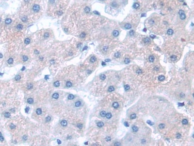 Polyclonal Antibody to G Protein Beta Subunit Like Protein (GbL)