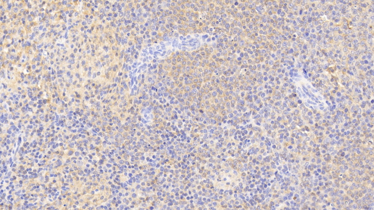 Polyclonal Antibody to Pim-3 Oncogene (PIM3)