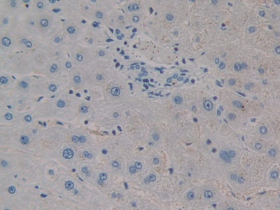 Polyclonal Antibody to Collagen Triple Helix Repeat Containing Protein 1 (CTHRC1)