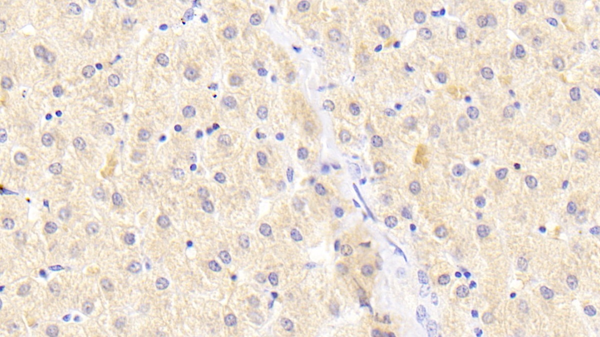 Polyclonal Antibody to Autophagy Related Protein 16 Like Protein 1 (ATG16L1)