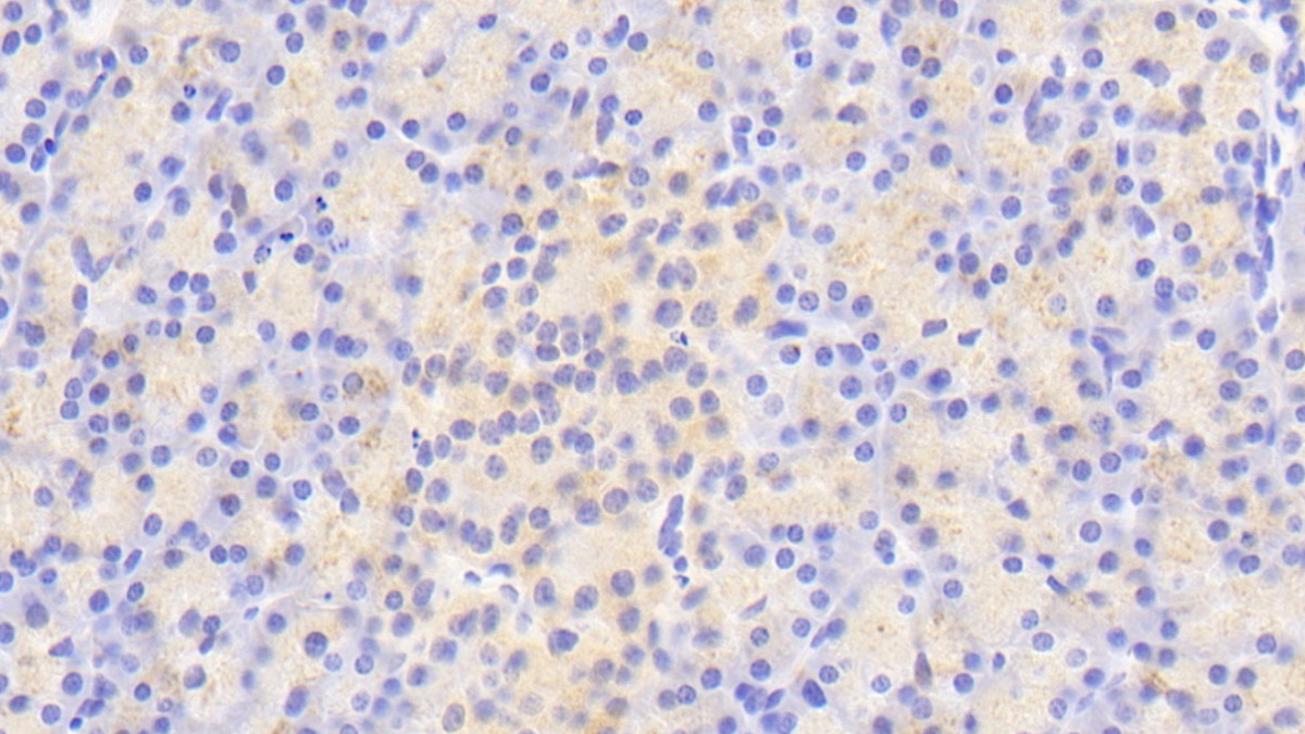 Polyclonal Antibody to Autophagy Related Protein 16 Like Protein 1 (ATG16L1)