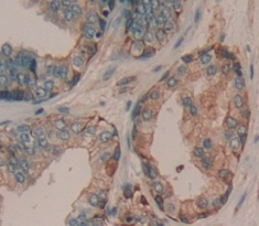 Polyclonal Antibody to A Disintegrin And Metalloproteinase With Thrombospondin 16 (ADAMTS16)