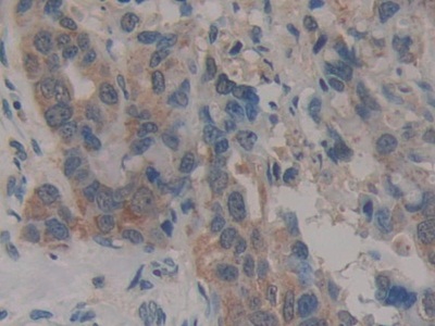 Polyclonal Antibody to Caspase Recruitment Domain Family, Member 9 (CARD9)