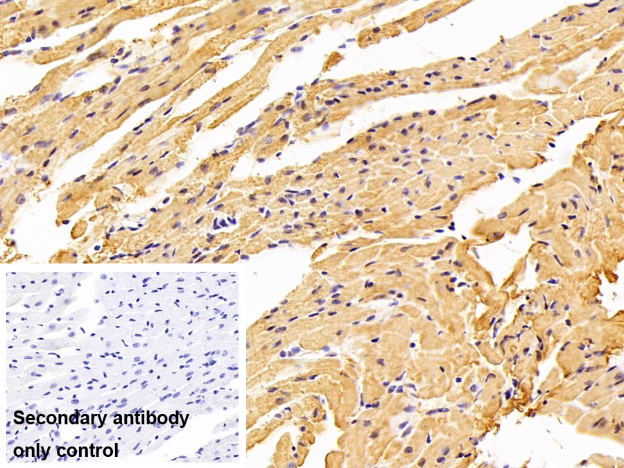 Polyclonal Antibody to Myosin Heavy Chain 7B, Cardiac Muscle Beta (MYH7B)