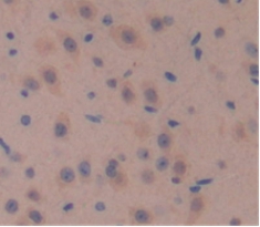 Polyclonal Antibody to Wingless Type MMTV Integration Site Family, Member 10A (WNT10A)