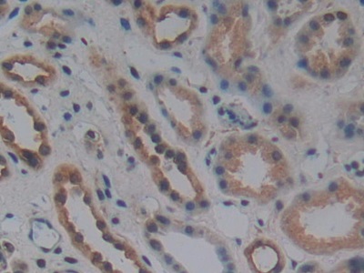 Polyclonal Antibody to Wingless Type MMTV Integration Site Family, Member 10B (WNT10B)