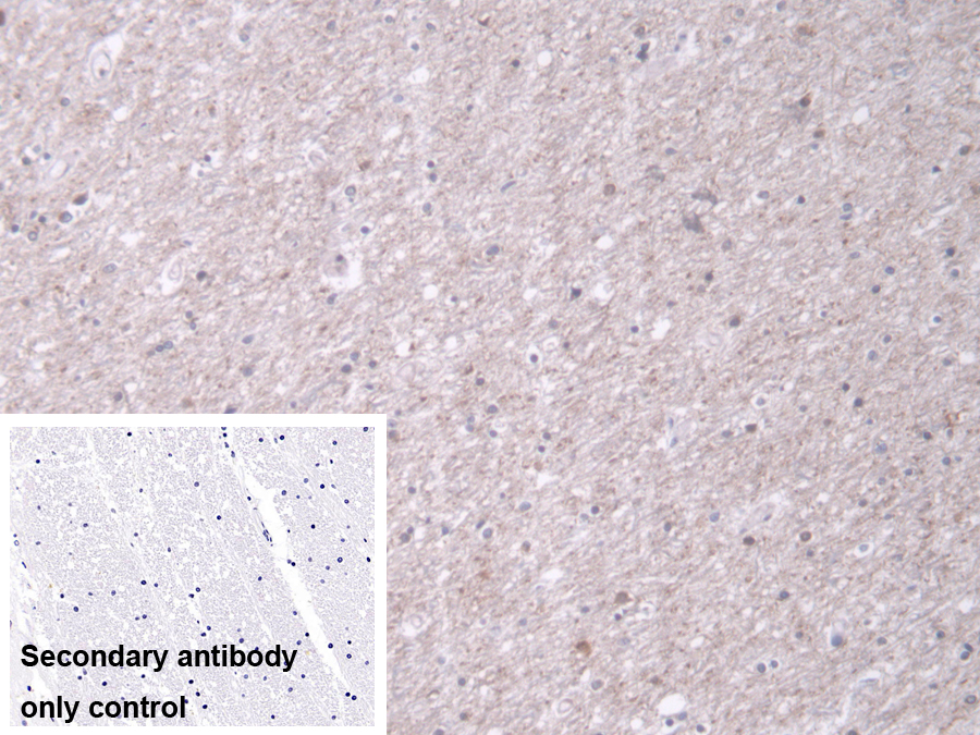 Polyclonal Antibody to Translocase Of Outer Mitochondrial Membrane 70A (TOMM70A)