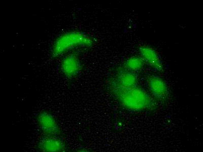 Polyclonal Antibody to Proteasome 26S Subunit, Non ATPase 10 (PSMD10)