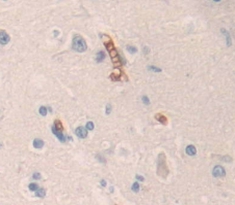 Polyclonal Antibody to Contactin 6 (CNTN6)