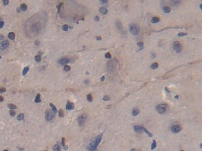 Polyclonal Antibody to Cluster Of Differentiation 8b (CD8b)