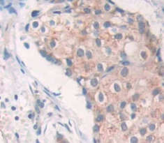 Polyclonal Antibody to SRSF Protein Kinase 3 (SRPK3)