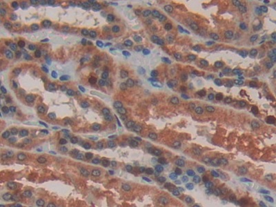 Polyclonal Antibody to RAD54 Like Protein 2 (RAD54L2)