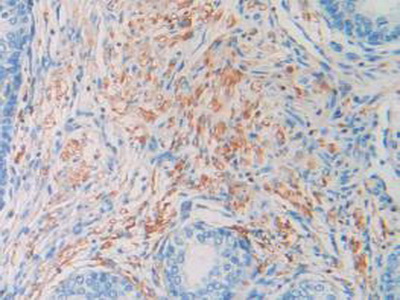 Polyclonal Antibody to Histone Cluster 1, H2ag (HIST1H2AG)
