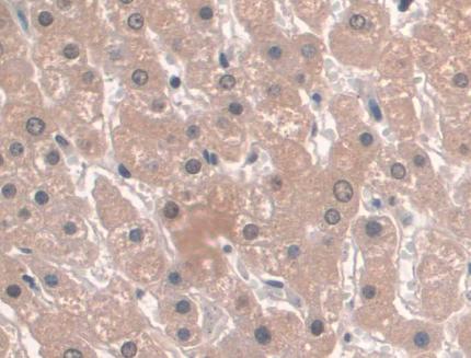 Recombinant Antibody to Apolipoprotein A1 (APOA1)