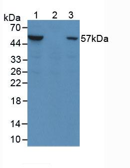 Anti-Phosphorylated Protein Kinase B Alpha (PKBa) Monoclonal Antibody