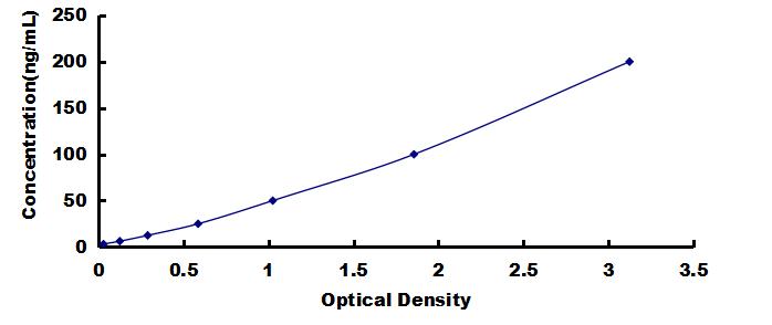 ELISA Kit for Anti-Sjogren Syndrome Antigen B Antibody (Anti-SSB)