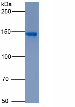 Active Angiotensin I Converting Enzyme (ACE)