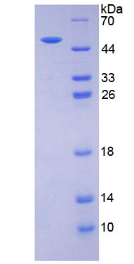 Active Erythropoietin (EPO)