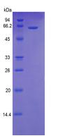 Active Factor Related Apoptosis (FAS)