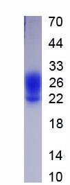 Active Factor Related Apoptosis (FAS)