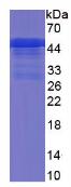 Active Factor Related Apoptosis Ligand (FASL)