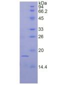 Active Fibroblast Growth Factor 1, Acidic (FGF1)