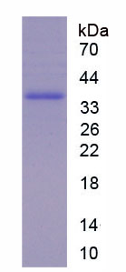 Active Chemokine C-X3-C-Motif Ligand 1 (CX3CL1)