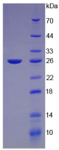 Active Growth Hormone (GH)