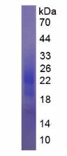 Active Colony Stimulating Factor 2, Granulocyte Macrophage (GM-CSF)