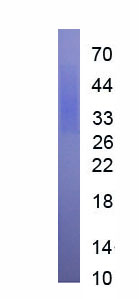 Active Glycoprotein 130 (gp130)