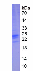 Active Interferon Gamma (IFNg)