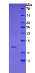 Active Insulin Like Growth Factor 1 (IGF1)