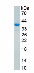 Active Insulin Like Growth Factor 1 (IGF1)