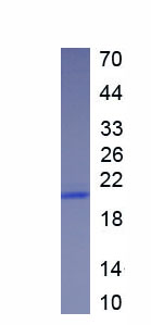 Active Insulin Like Growth Factor Binding Protein 2 (IGFBP2)