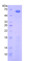 Active Insulin Like Growth Factor Binding Protein 2 (IGFBP2)