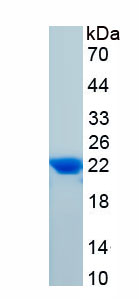 Active Insulin Like Growth Factor Binding Protein 3 (IGFBP3)