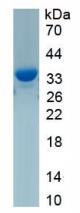 Active Insulin Like Growth Factor Binding Protein 3 (IGFBP3)