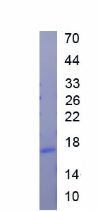 Active Insulin Like Growth Factor Binding Protein 3 (IGFBP3)