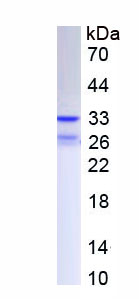 Active Interleukin 12A (IL12A)