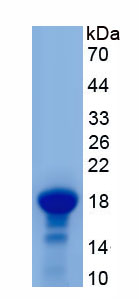 Active Interleukin 18 (IL18)