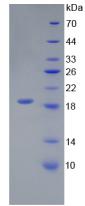 Active Interleukin 18 (IL18)