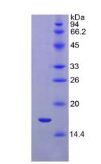 Active Interleukin 1 Receptor Type I (IL1R1)