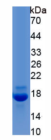 Active Interleukin 2 (IL2)